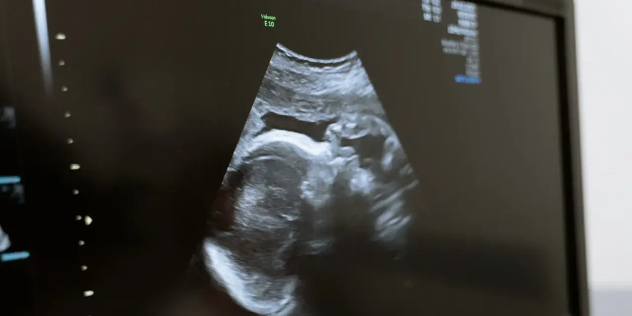 USG płodu w Holandii. Obraz z kliniki NovaMed pokazuje profil dziecka.