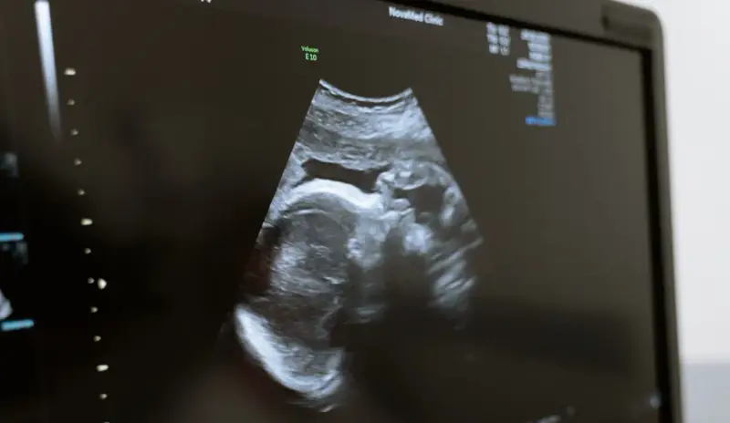 USG płodu w Holandii. Obraz z kliniki NovaMed pokazuje profil dziecka.
